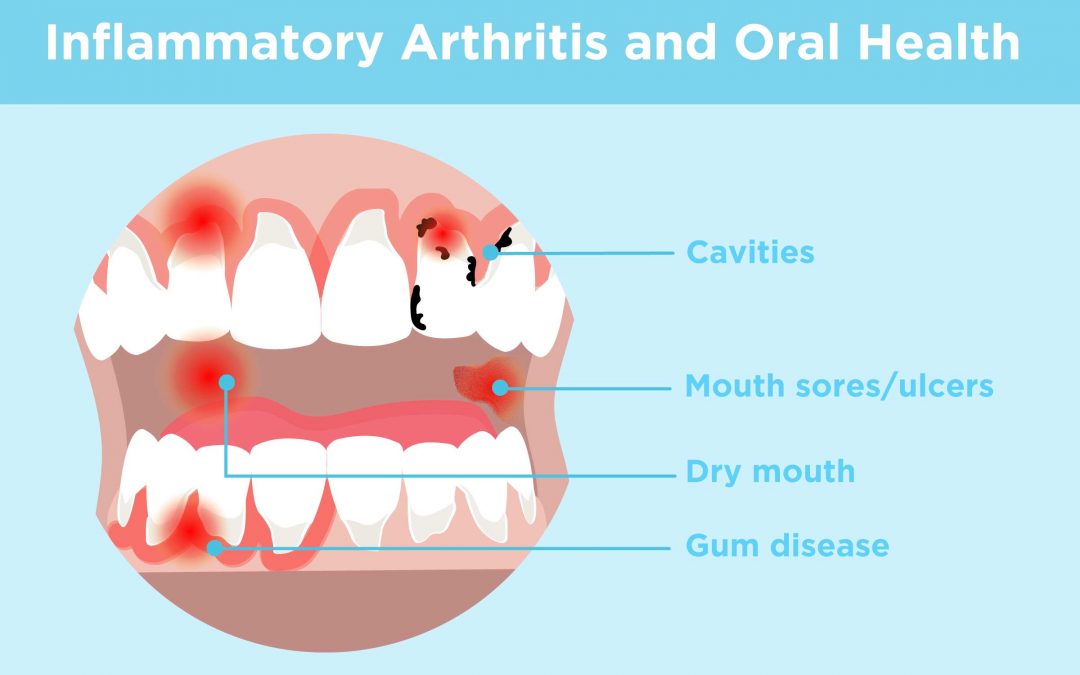 أمراض الفم الجراحية عند الأطفال التي يمكن إجراؤها في العيادة
