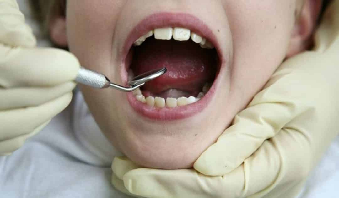 ١٠ اسباب تجعل الناس تكره طبيب الأسنان , لماذا يكره الناس طبيب الاسنان ؟