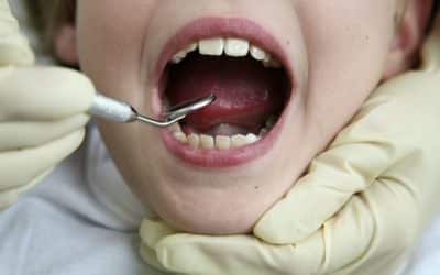 ١٠ اسباب تجعل الناس تكره طبيب الأسنان , لماذا يكره الناس طبيب الاسنان ؟