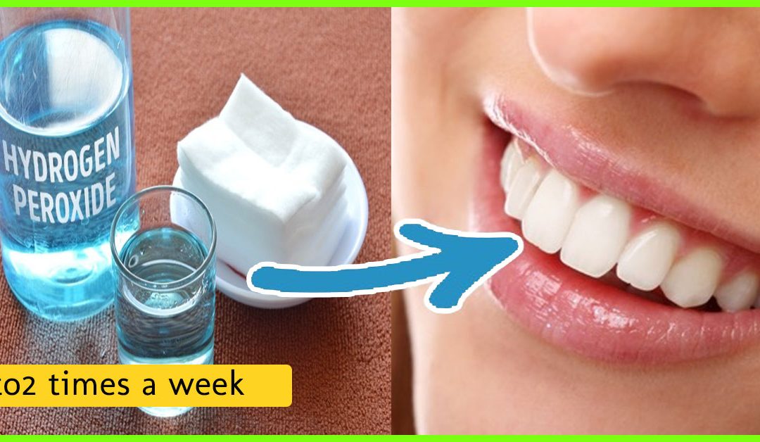 خلطة تبييض وصفة لتبيض الاسنان مع بيروكسيد الهيدروجين