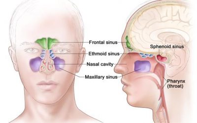 كشف التهابات وأورام الجيب الفكي Maxillary Sinus شعاعياً