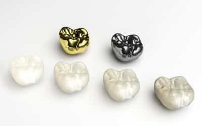 انواع التيجان حسب نوع الخزف Ceramic Crown Types