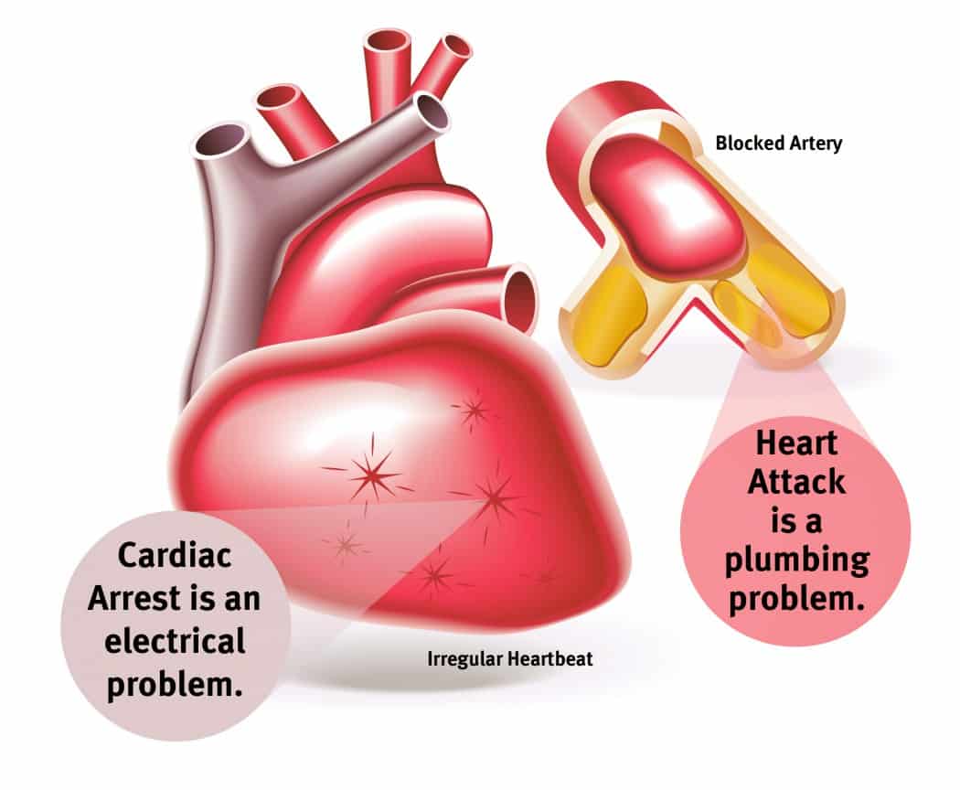 cardiac-arrest-dalsty