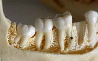 زرع الأسنان المنقولة Transplantation of teeth