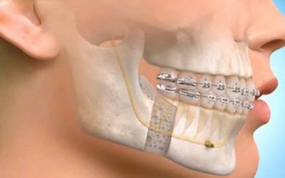 المهام والمعالجات التي من صلاحيات طبيب الاسنان الجراح