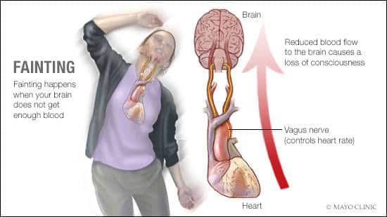 fainting-causes-signs-and-symptoms-diagnosis-and-treatment-youtube