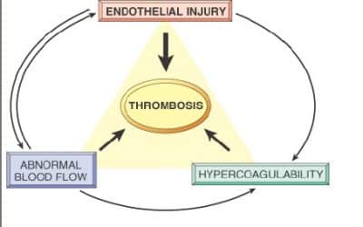 الاضطرابات الدورانية في الالتهابات