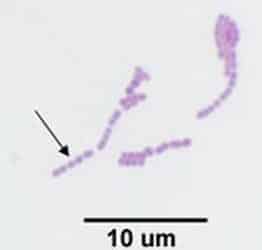 المكورات العقدية Streptococcus