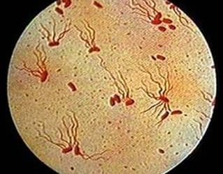 السامونيلا Salmonelleae