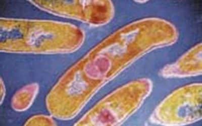 الليستيريا وحيدة النواة Listeriae monocytogenes