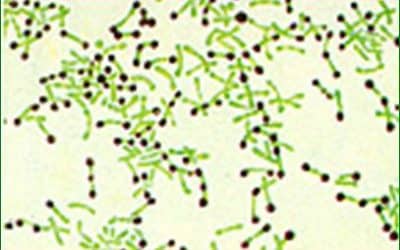 الوتديات الخناقيةDiphteriae Corynebacterium