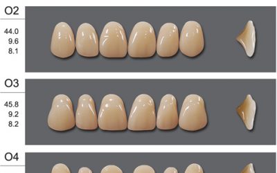 انتقاء الأسنان الاصطناعية وتنضيدها في الأجهزة الجزئية Selection and Arrangement of Artificial Teeth