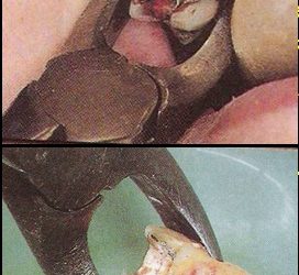 القلع و إعادة الزرع أو إعادة الزرع المقصودExtraction And Replantation-Intentional replantation