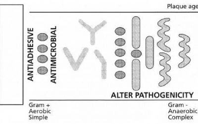 مفهوم السيطرة الكيميائية على اللويحة فوق اللثوية The concept of chemical supragingival plaque contro