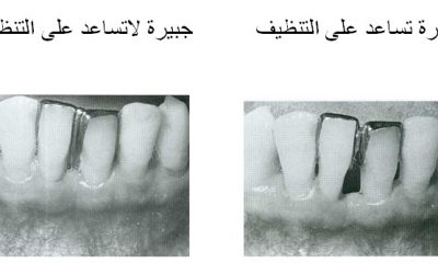 مبادئ المعالجة التعويضية لدى مرضى بنسج حول سنية متراجعة