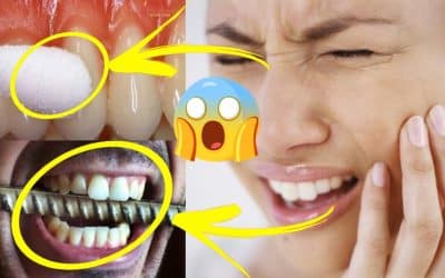 ١٠ امور تسبب الم الاسنان