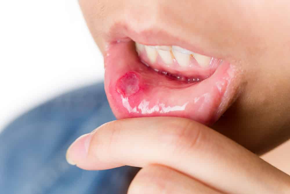 يوم امتحان امراض الفم ال oral medicine فيديو مضحك ; طب اسنان ; تو جوز