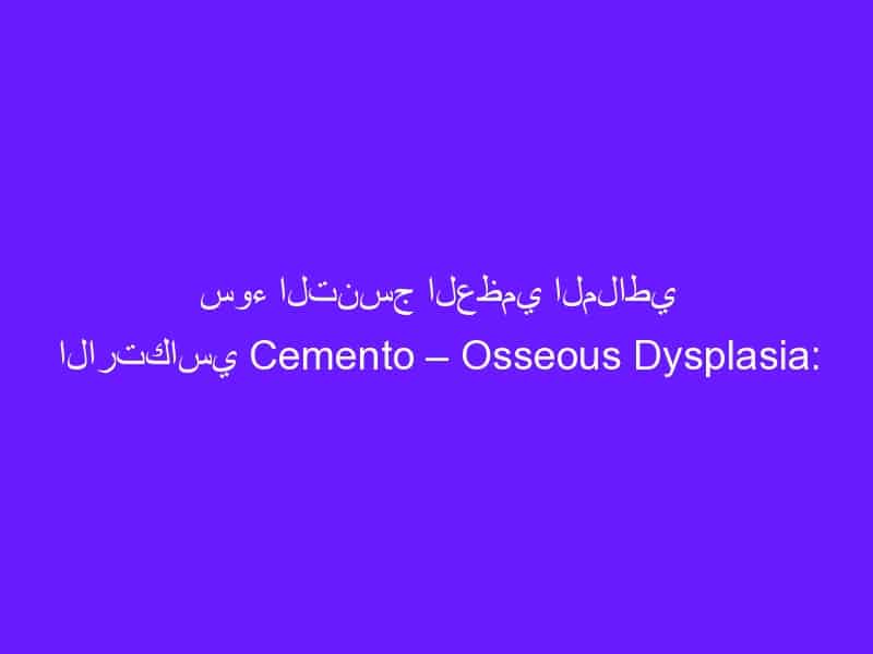 سوء التنسج العظمي الملاطي الارتكاسي Cemento – Osseous Dysplasia: