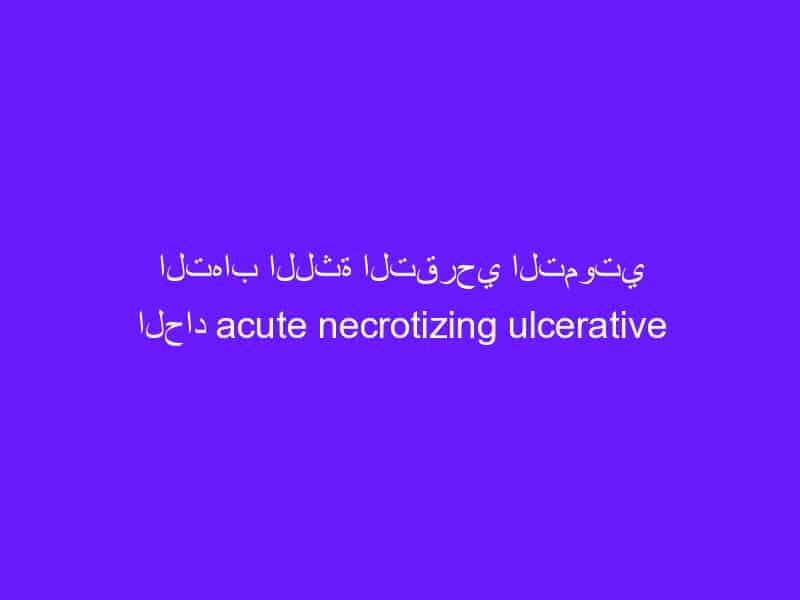 التهاب اللثة التقرحي التموتي الحاد acute necrotizing ulcerative gingivitis