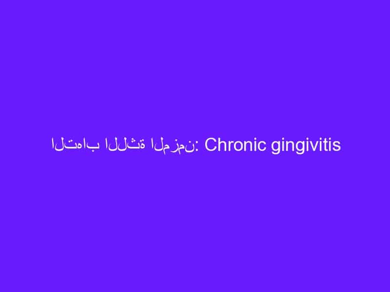 التهاب اللثة المزمن: Chronic gingivitis