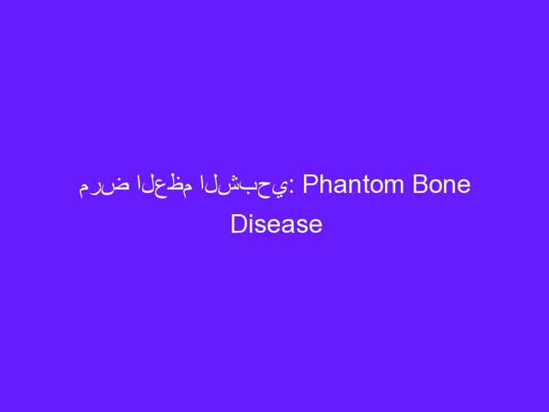 مرض العظم الشبحي: Phantom Bone Disease