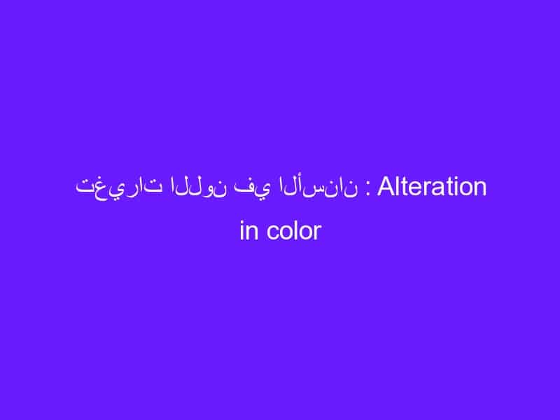 تغيرات اللون في الأسنان : Alteration in color