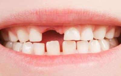 أهمية الأسنان المؤقتة عند الاطفال
